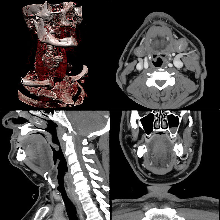 Tecnologia moderna de imagem médica 3D. As técnicas de expressão tridimensional de Michelangelo influenciam até mesmo as mais recentes tecnologias médicas.